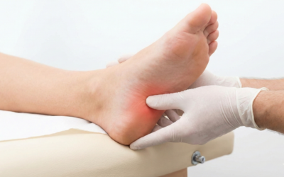 Comment soulager l&rsquo;aponévrosite plantaire par la fasciathérapie ?